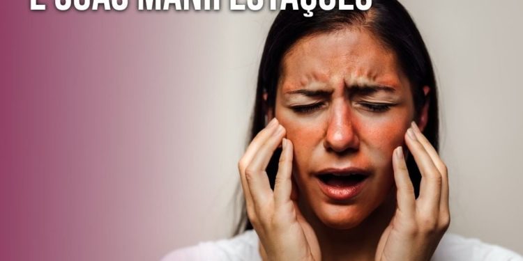 Lúpus e suas manifestações