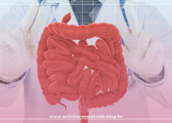 3 medicamentos biológicos para tratamento da retocolite ulcerativa são incluídos no rol da ANS