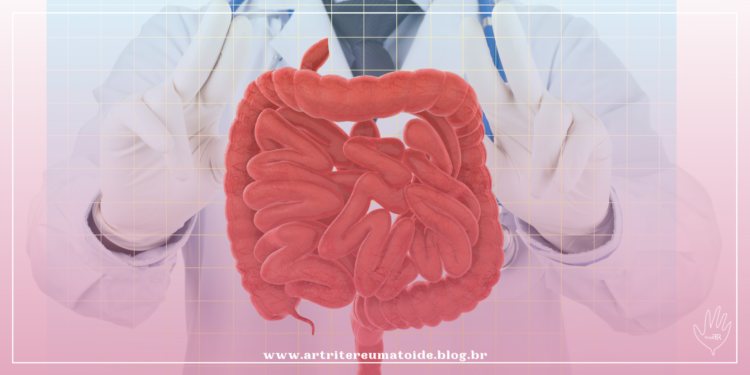 3 medicamentos biológicos para tratamento da retocolite ulcerativa são incluídos no rol da ANS