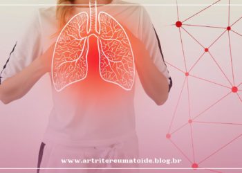 Saiba o que é a síndrome pós-covid e como o reumatologista pode contribuir para o seu controle