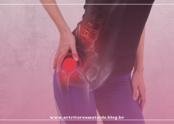 Jovem e com dor no quadril? Veja como reverter esse quadro