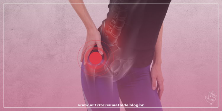 Jovem e com dor no quadril? Veja como reverter esse quadro