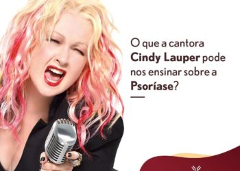 O que a cantora Cindy Lauper pode nos ensinar sobre a Psoríase?