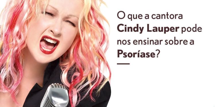 O que a cantora Cindy Lauper pode nos ensinar sobre a Psoríase?