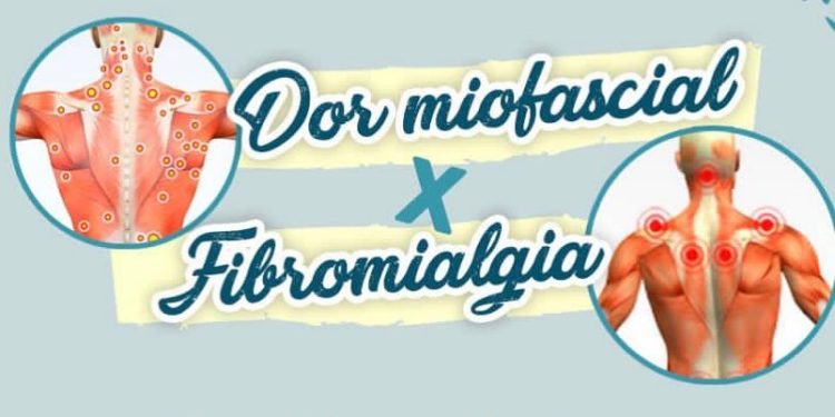 Dor miofascial x Fibromialgia: Saiba a diferença entre as duas