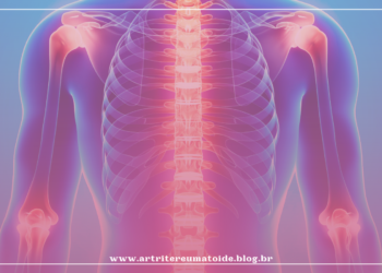 Articulações inflamadas: o que será e o que fazer?