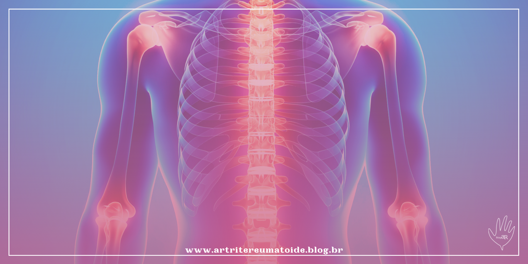 Como saber se as articulações estão inflamadas?