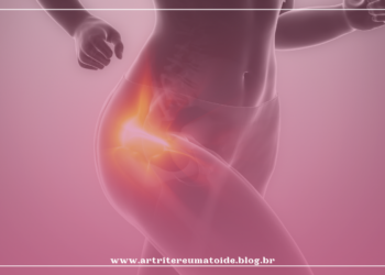 Doenças do quadril estão entre as que mais causam perda da qualidade de vida e podem ser solucionadas por especialistas