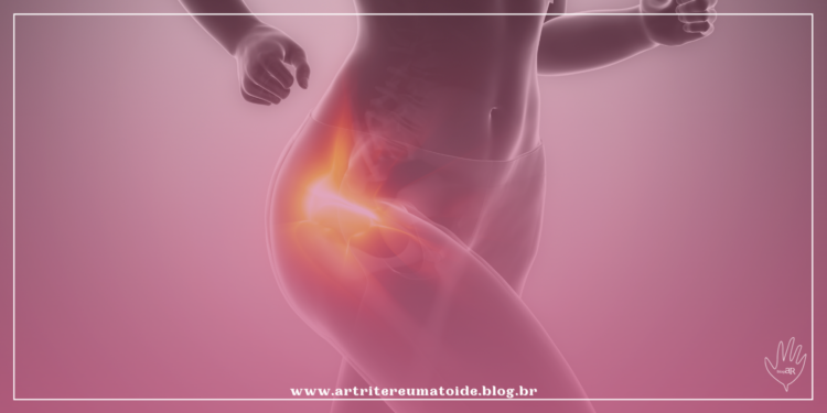 Doenças do quadril estão entre as que mais causam perda da qualidade de vida e podem ser solucionadas por especialistas