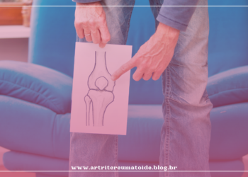 Sedentarismo forçado na pandemia aumenta problemas nos joelhos e acende alerta para revisão das próteses