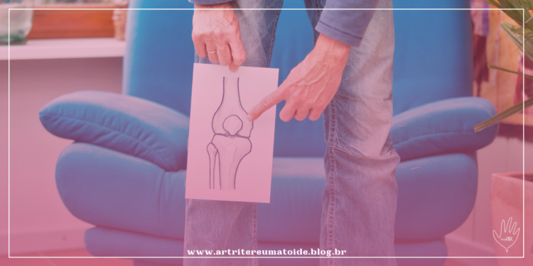 Sedentarismo forçado na pandemia aumenta problemas nos joelhos e acende alerta para revisão das próteses