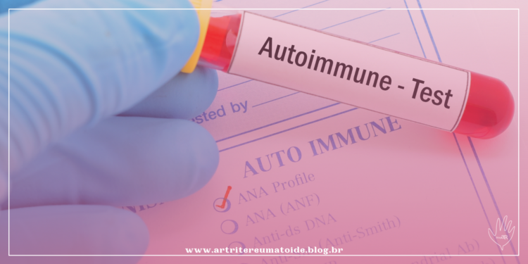 Novo estudo sugere que a fibromialgia pode ser uma doença autoimune