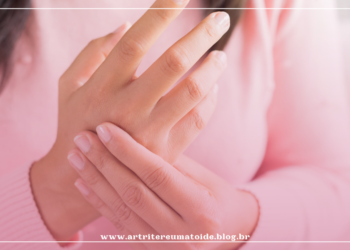 Artrite Lúpica: entenda como a doença funciona