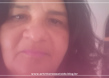 “Como tenho me sentido ao desinchar, depois de fazer uso do corticoide por 15 anos”