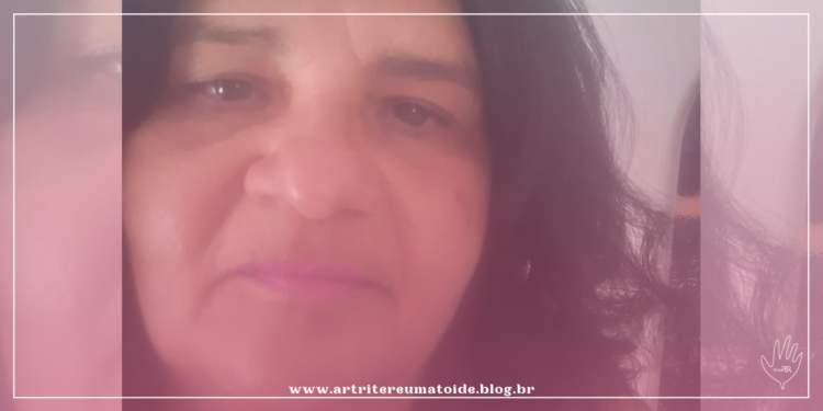 “Como tenho me sentido ao desinchar, depois de fazer uso do corticoide por 15 anos”