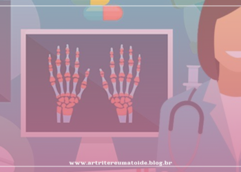 Doenças reumáticas imunomediadas e o tratamento com medicamentos imunobiológicos I Live: 19 de julho de 2021