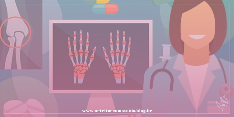 Doenças reumáticas imunomediadas e o tratamento com medicamentos imunobiológicos I Live: 19 de julho de 2021