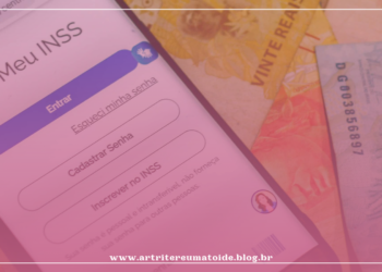 Desastre anunciado: projeto de lei obriga segurado a pagar perícia médica