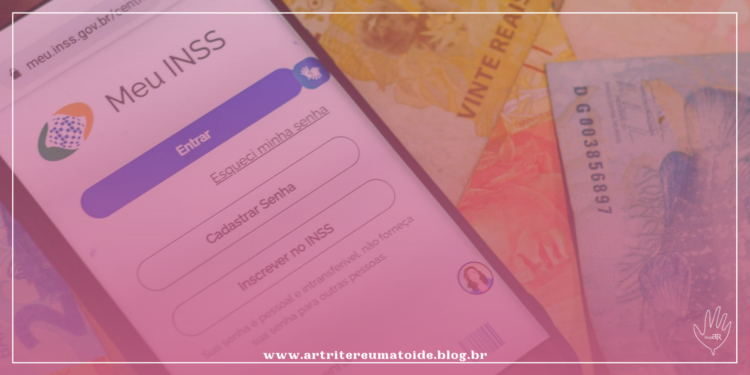 Desastre anunciado: projeto de lei obriga segurado a pagar perícia médica