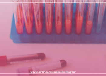 Sintomas da fibromialgia são consequência da ação de anticorpos do próprio paciente