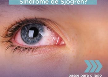 Você já ouviu falar da síndrome de Sjögren?
