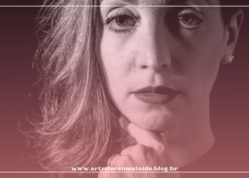 Compartilhando minha “saga” com com a Artrite Psoriásica há mais de 5 anos