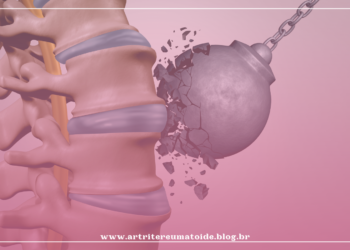 Como manter os ossos saudáveis e fortalecidos