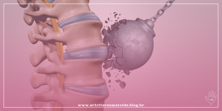 Como manter os ossos saudáveis e fortalecidos