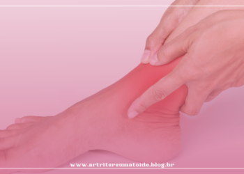 O inchaço no tornozelo é um sinal de doença?