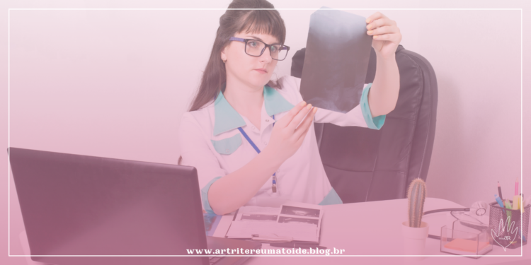 Quando devo ir em um reumatologista e o que faz essa especialidade?