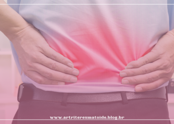 Tenho 54 anos e sofro com dores na lombar. O que devo fazer para melhorar?