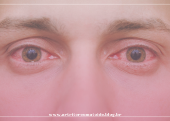 Frio e home office aumentam casos de Olho Seco