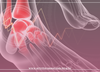 Em cirurgia inédita em Minas, paciente recebe prótese no tornozelo esquerdo