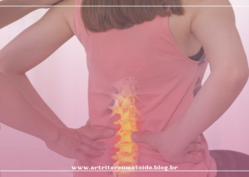 Dor nas costas não é normal e pode ser sinal de doença crônica