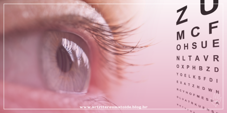 Olho seco pode afetar seis em cada 10 pacientes com glaucoma