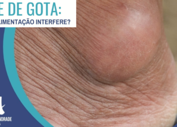 Crise de Gota  – Como a alimentação interfere?