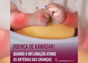 Doença de Kawasaki