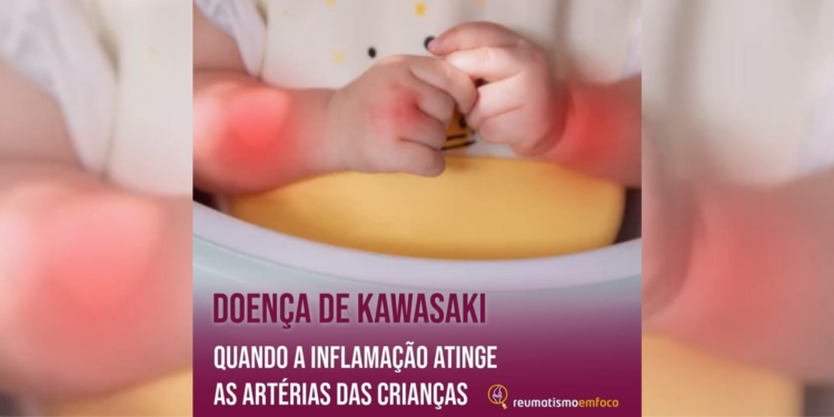 Doença de Kawasaki