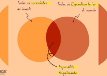 Nem toda sacroileíte é uma espondiloartrite. E nem toda espondiloartrite tem sacroileíte!