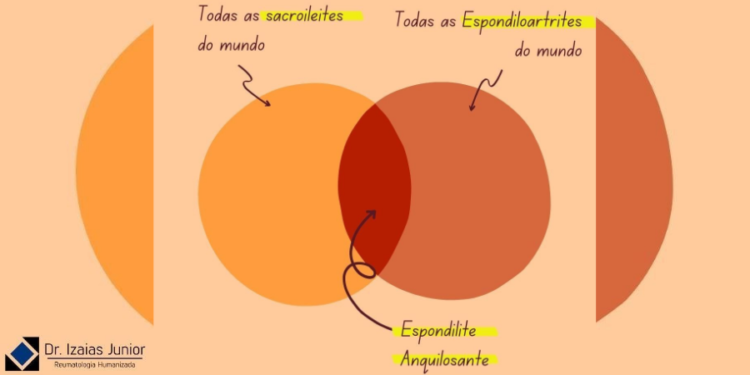 Nem toda sacroileíte é uma espondiloartrite. E nem toda espondiloartrite tem sacroileíte!