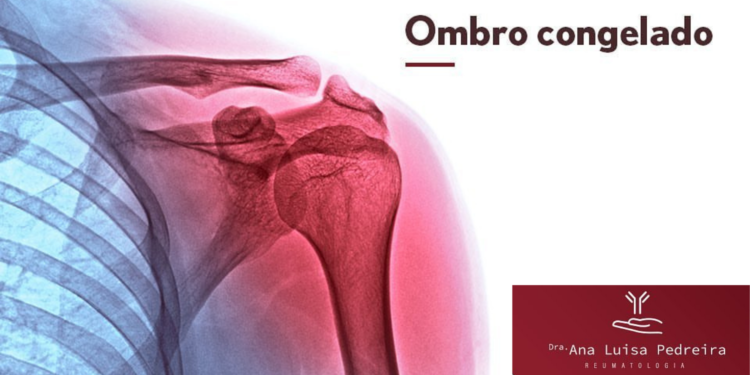 Ombro congelado