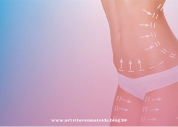 Estudo avaliará efeitos das cirurgias estéticas em doentes reumáticos