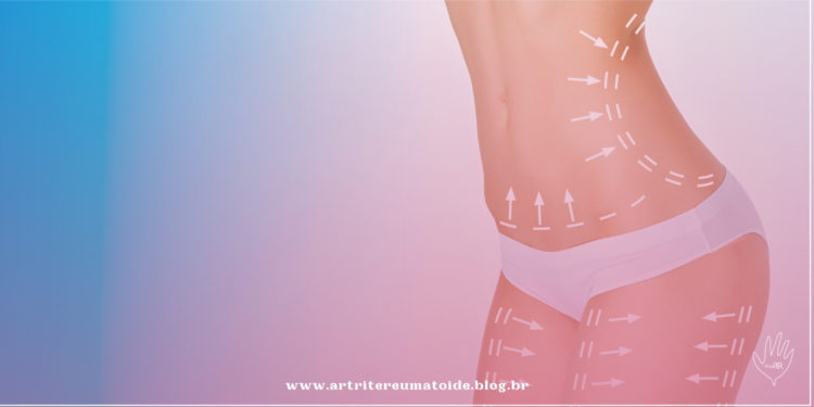 Estudo avaliará efeitos das cirurgias estéticas em doentes reumáticos