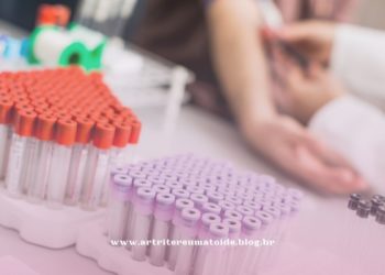 Exame inovador para detectar a tuberculose em pacientes sem sintomas está disponível para o SUS