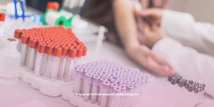 Exame inovador para detectar a tuberculose em pacientes sem sintomas está disponível para o SUS