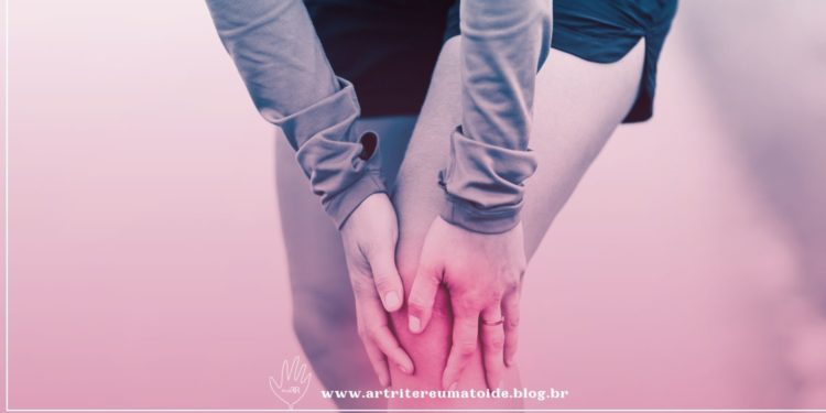 Pacientes com artrite reumatoide relatam jornada longa, passando por pelo menos quatro médicos até descobrirem a doença
