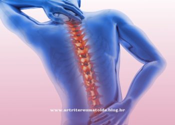 Osteoporose: novo medicamento promove ganhos importantes de massa óssea