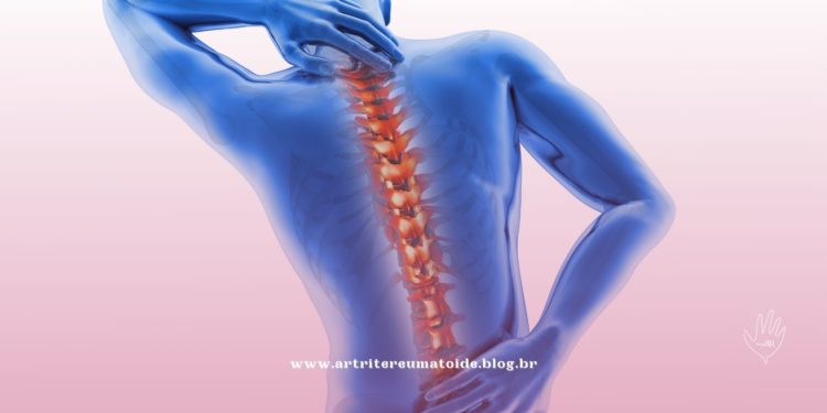 Osteoporose: novo medicamento promove ganhos importantes de massa óssea