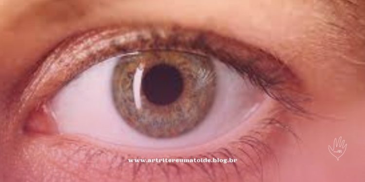 Pacientes com edema macular diabético aguardam liberação do Ministério da Saúde para ter acesso gratuito a medicamento