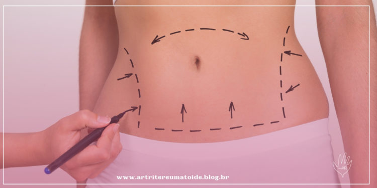 Cirurgia Plástica em Pacientes com Artrite Reumatoide